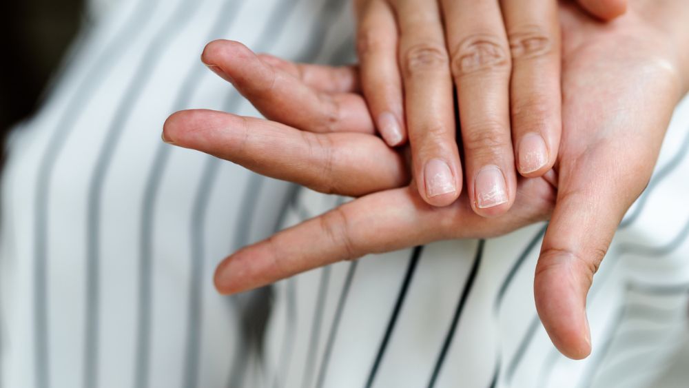 Last van broze nagels? Zó maak je ze weer sterk