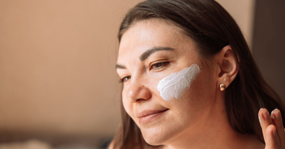 Vrouw met zonnebrand op gezicht